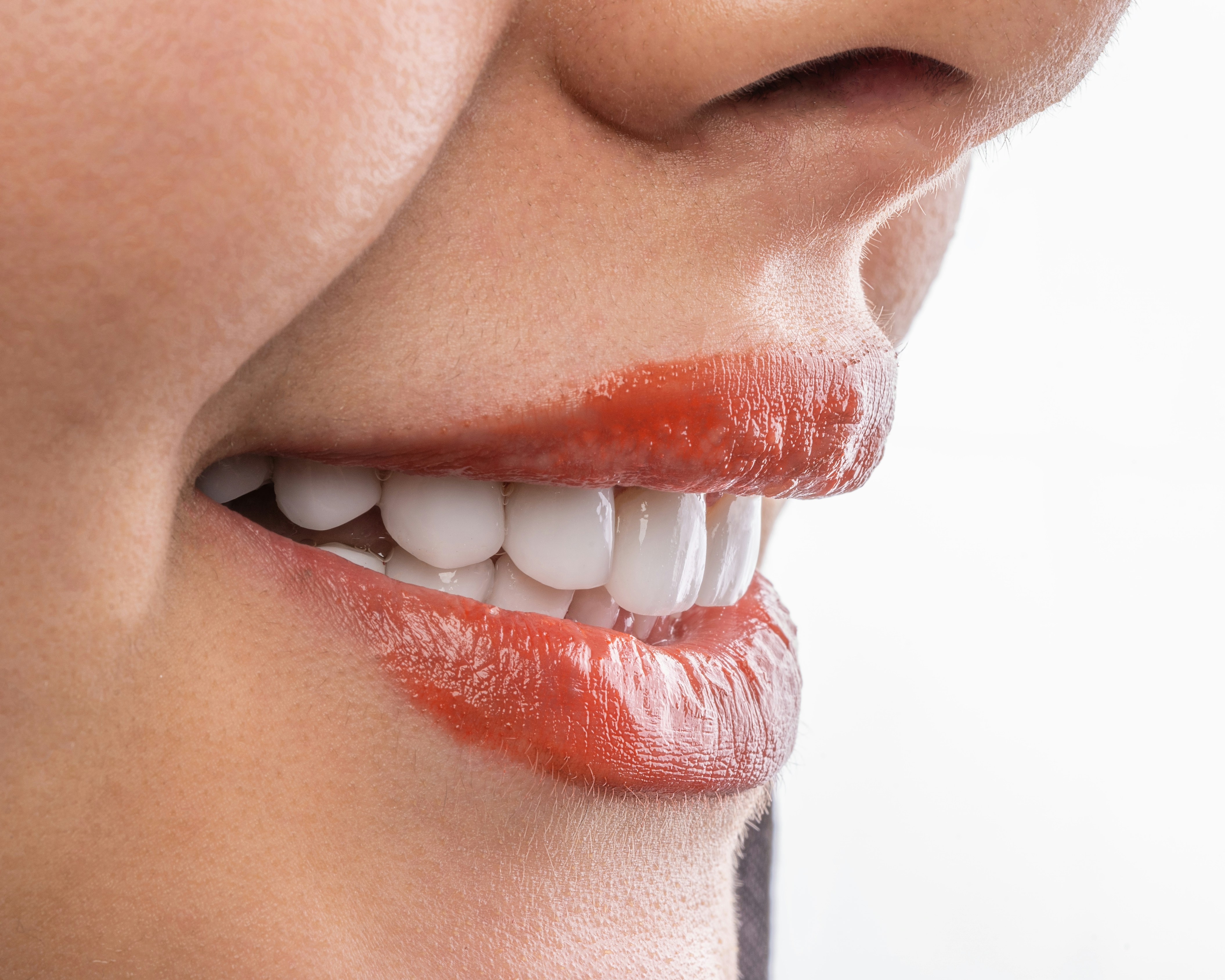 Blanqueamiento Dental Zoom! en Panamá