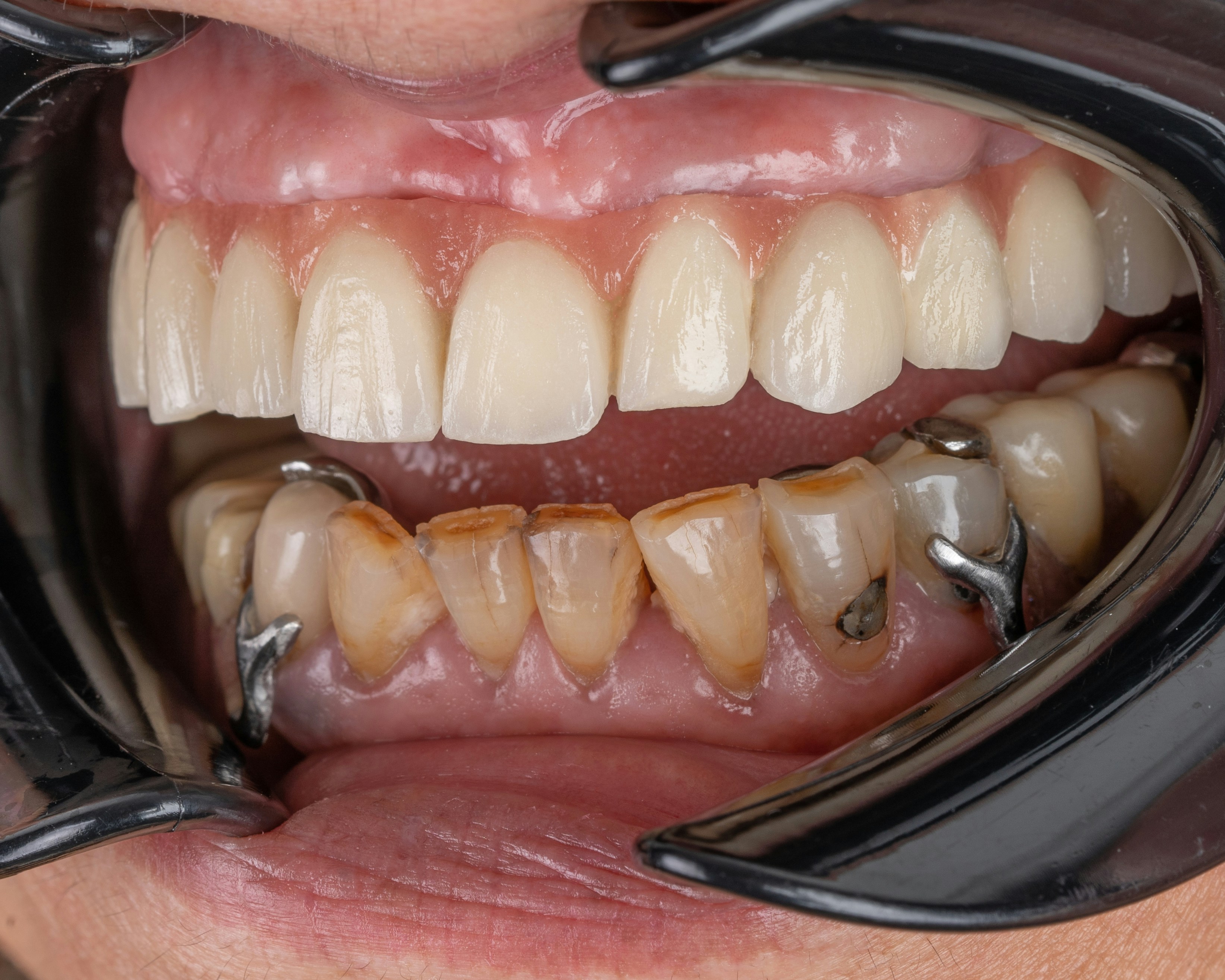 Odontología General y Preventiva en Panamá